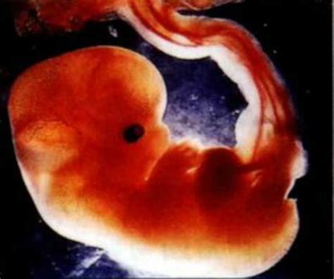 一个月的胚胎属于生命吗