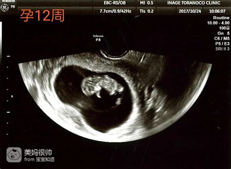 三个月的胎儿的样子