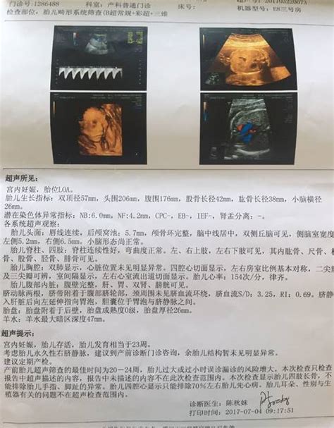 上海市妇幼保健院彩超单
