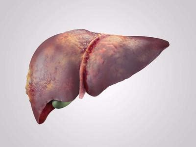 人的肝脏摘除能活多久