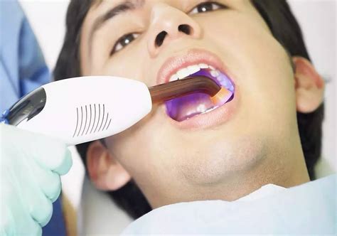 口腔诊所看牙会不会感染艾滋病