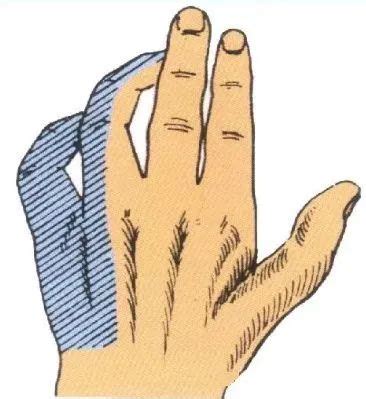 右手无名指小手指麻木提示什么病