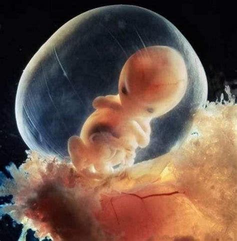 四个月的胎儿图片