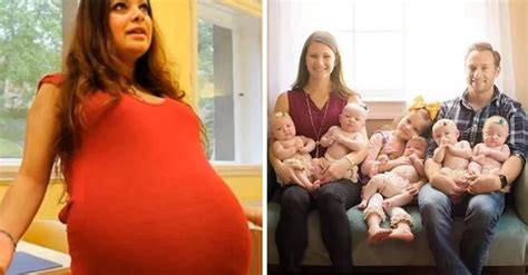 女子怀上双胞胎却是20斤的肿瘤
