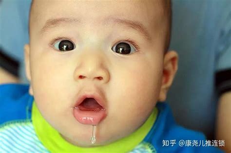 婴幼儿流口水特别多需要治疗吗