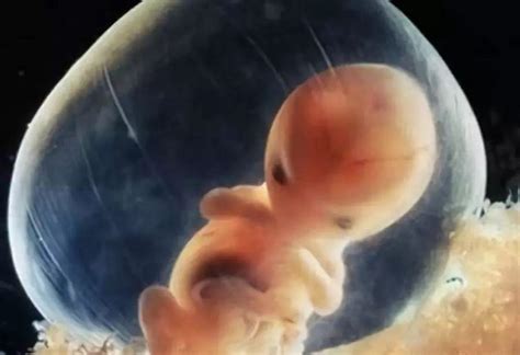 孕囊是胚胎还是生命