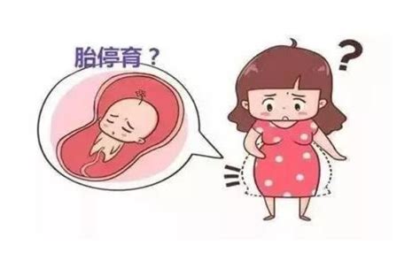 孕妇多少周容易出现胎停
