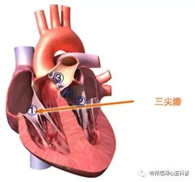 心脏反流现象怎么治能治愈吗
