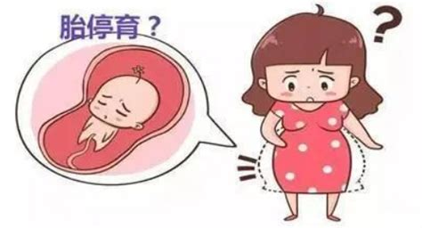 怀孕13周胎停了怎么办