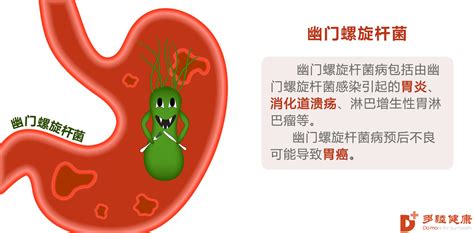 感染幽门螺杆菌或诱发胃癌