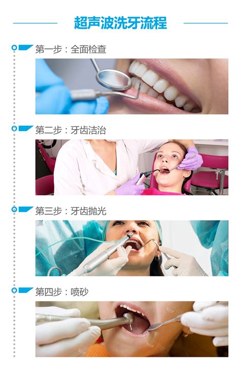 洁牙患者的接待流程