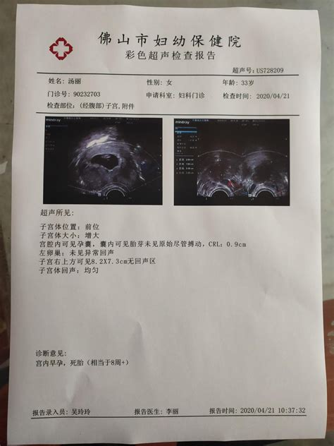 深圳医院b超单最新图片