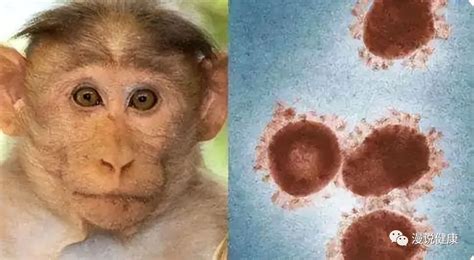 猴痘是人畜共患病吗