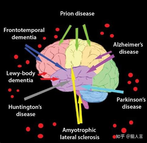 神经退行性疾病脑铁沉积6型的症状