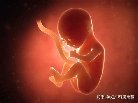胎儿一般在几周会脐带绕颈