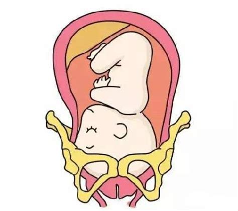 胎儿入盆 示意图