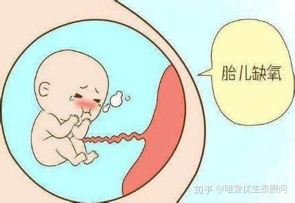 胎儿在几周开始预防缺氧