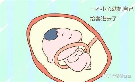 胎儿多少周开始出现脐带绕颈