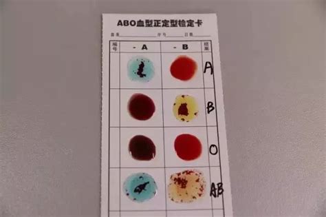 血型怎么测