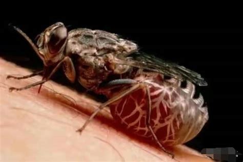 非洲人身上的果蝇被医生取出