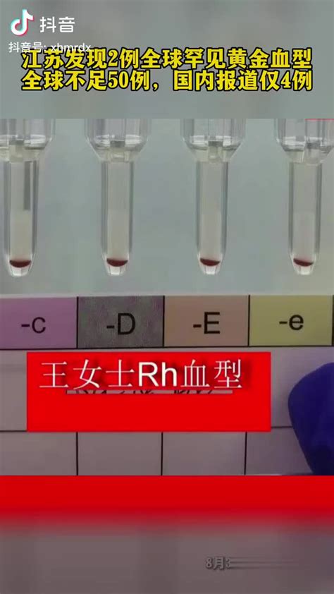2017年江苏孕妇发现罕见血型