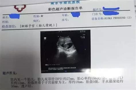 39高龄怀孕第一胎