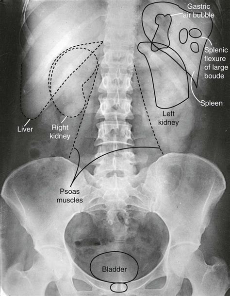abdominal radiology