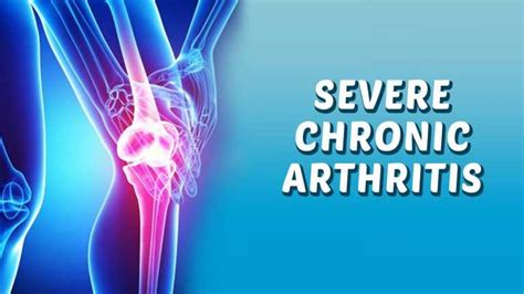 chronic arthritis