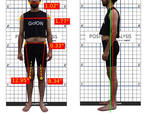 posture analysis