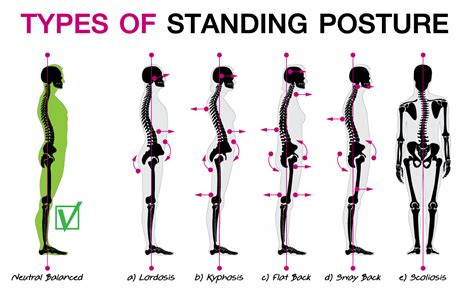 standard posture