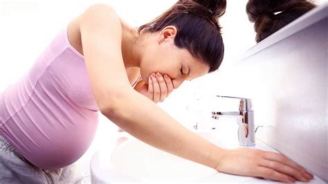 vomiting of pregnancy